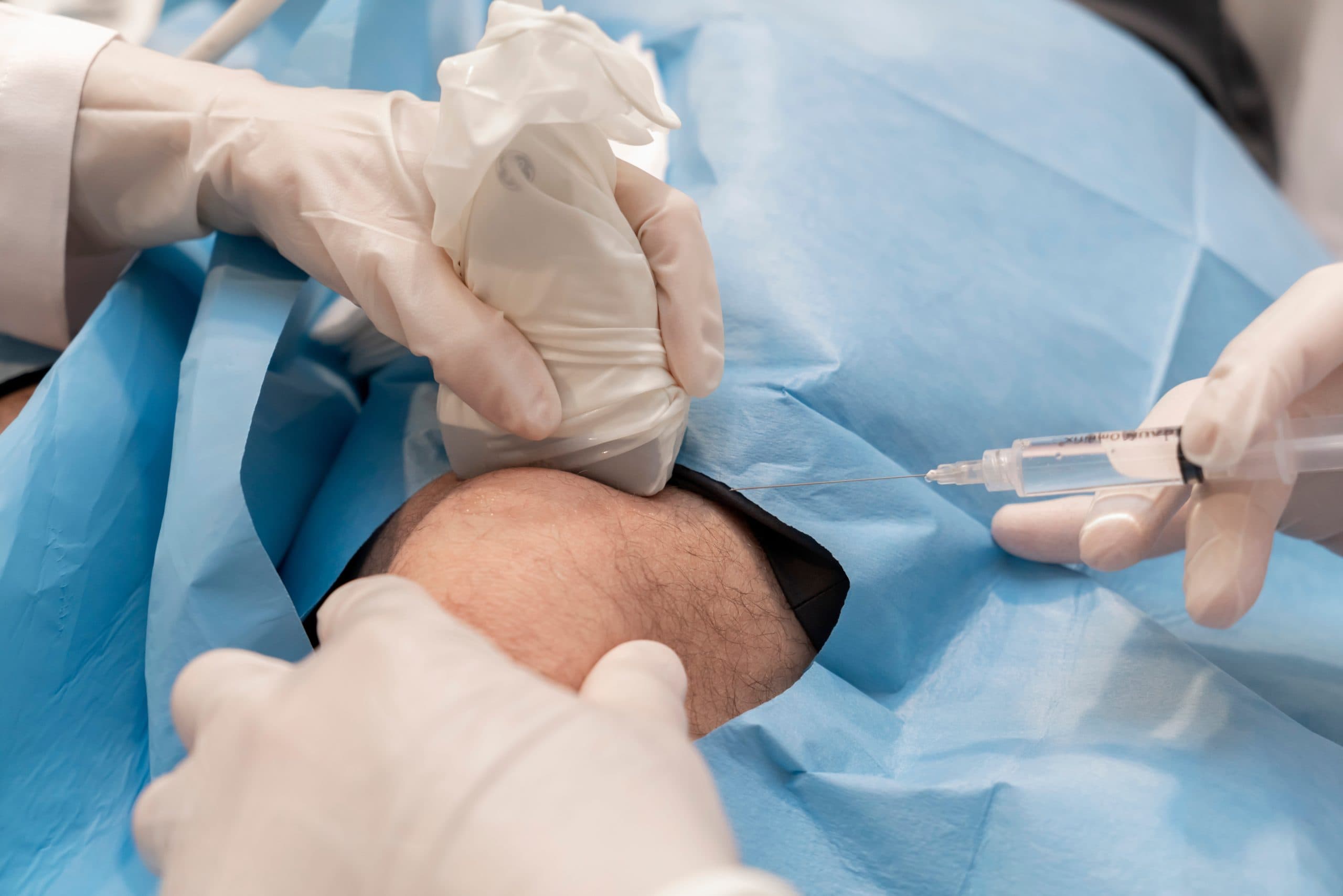 Regenerative cartilage tissue at London Cartilage Clinic